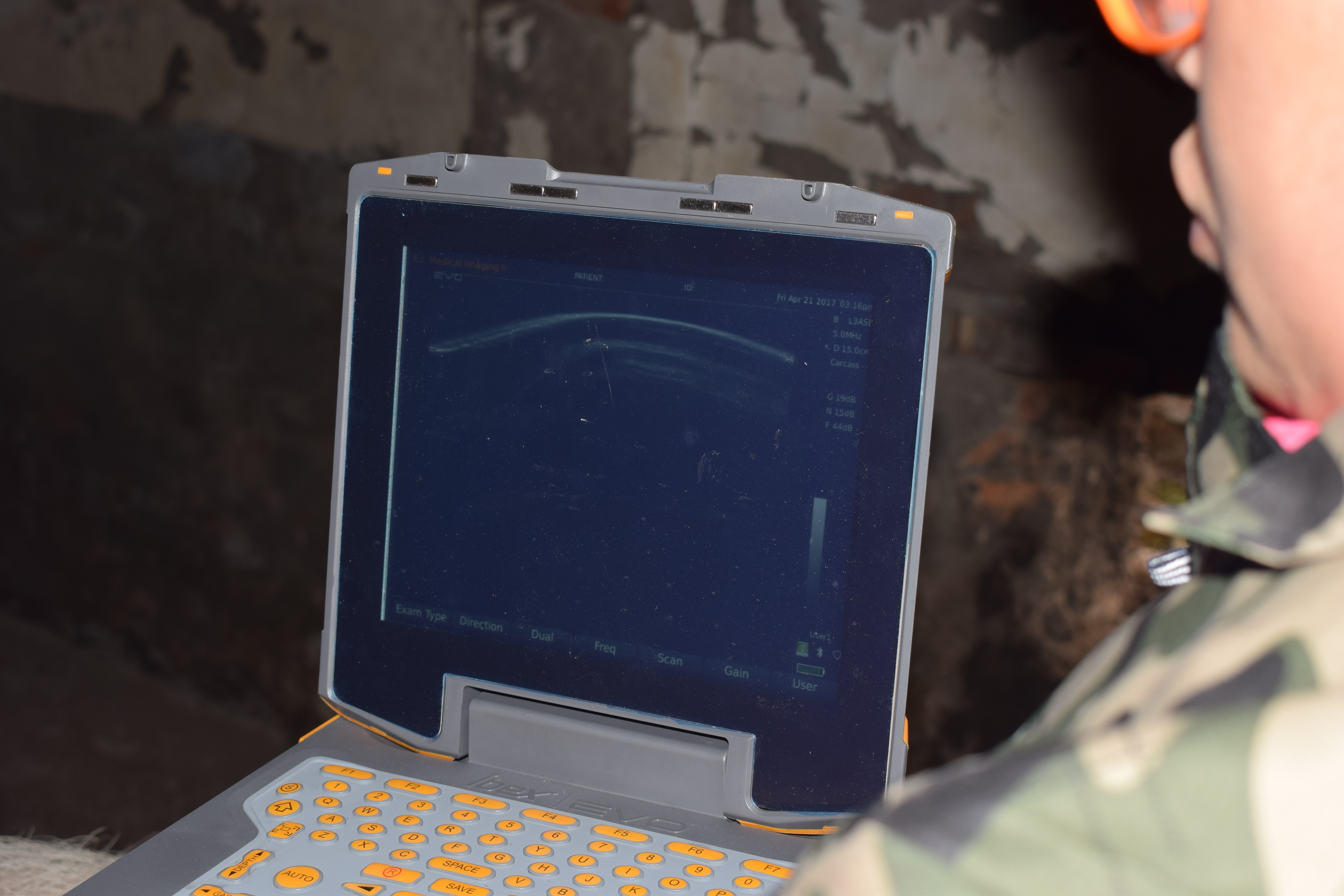 BXL animal ultrasound instrument pig farm backfat eye muscle test case(图26)