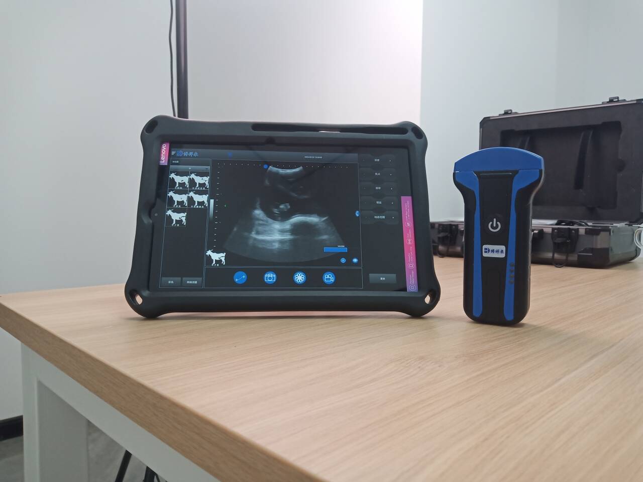 BXL Handheld Ultrasound Device: Revolutionizing Portable Diagnostic Imaging(图1)