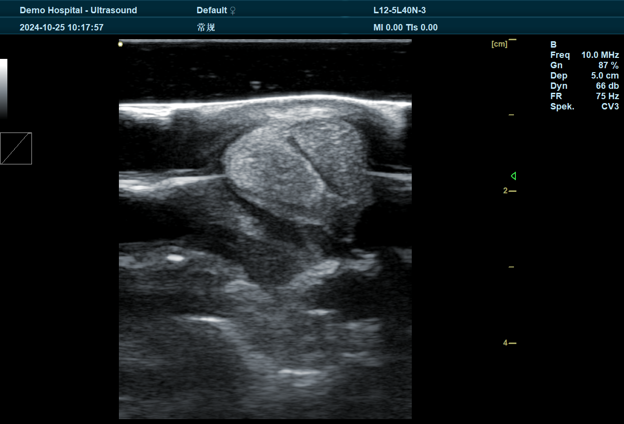 The Difference Between Ultrasound for Cattle and Ultrasound for Sheep(图1)
