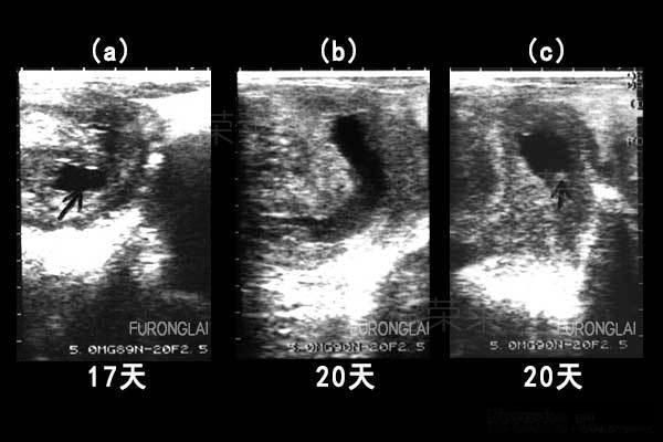 Why Is Ultrasound Equipment for Cattle So Popular?(图1)