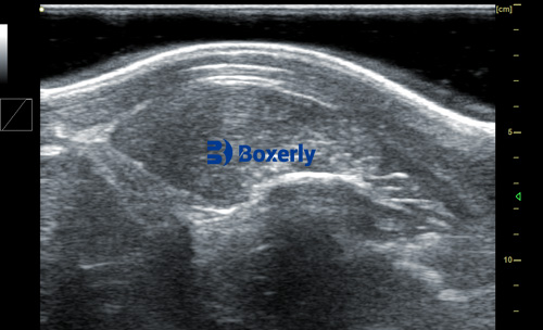 How Swine Ultrasound Machines and Smart Farming Systems Work Together to Boost Efficiency(图3)