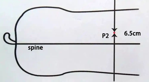 What is Back Fat Thickness in Ultrasound?(图2)
