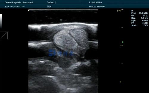 can a horse recover from a tendon injury(图4)