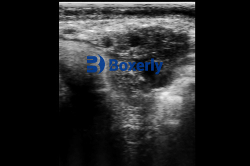 Advances in Ovum Pick Up Techniques for Cattle Reproduction(图2)