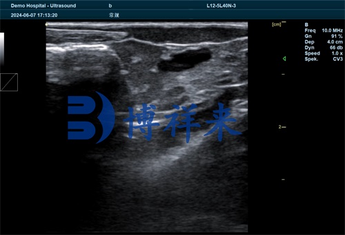 Fish Ultrasound Inspection and Suitable Model Solutions(图2)