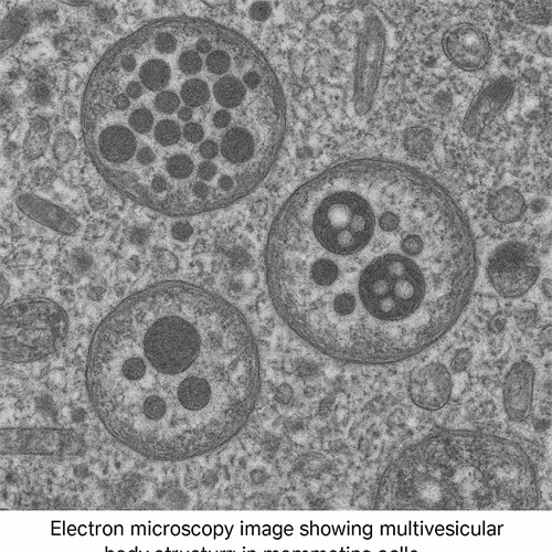 MVB in Veterinary Medicine Refers to Multivesicular Bodies(图2)