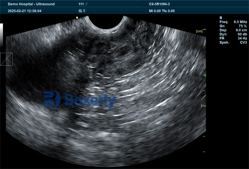 Three Ultrasonographic Cross-Sections During Transrectal Scanning in Ewes(图3)
