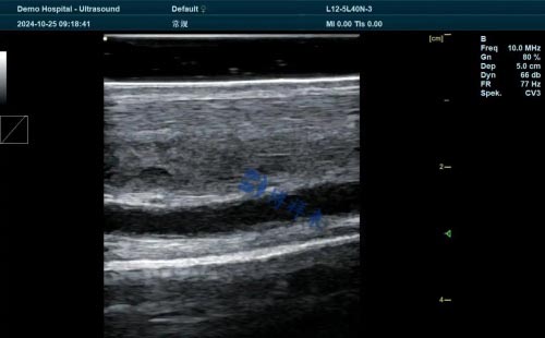 Nutritional Management Strategies for Pregnant Horses in Late Pregnancy(图2)