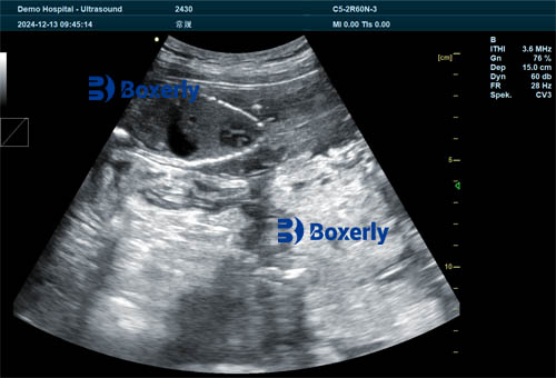 Common Causes of Sow Miscarriage — How Pig Pregnancy Scanners Help Reduce Losses(图4)